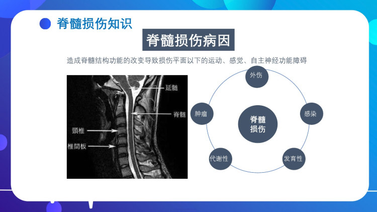 脊髓损伤治疗新进展，创新方法与康复策略的演变